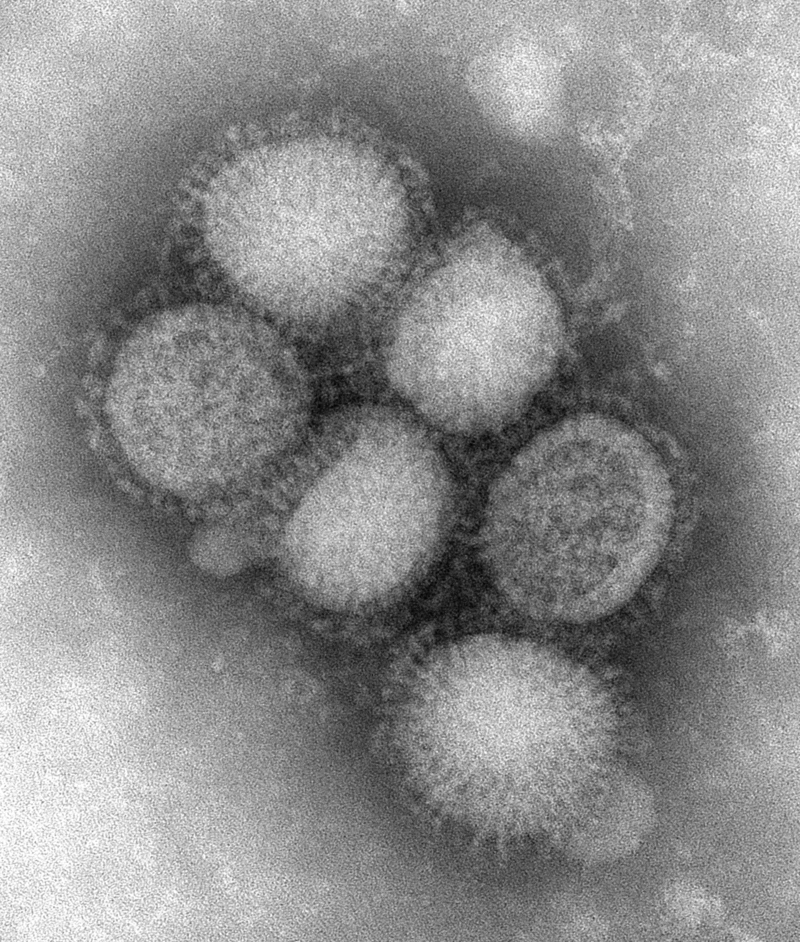 Eletromicrografia de vírions de Influenzavirus A (H1N1). Imagem: Wikimedia Commons.