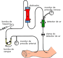 Representação esquemática do processo de hemodiálise. Imagem: Wikimedia Commons.