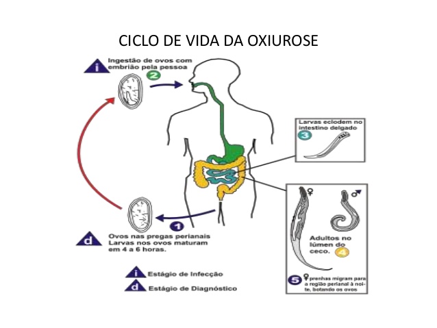 oxiurose o que sao